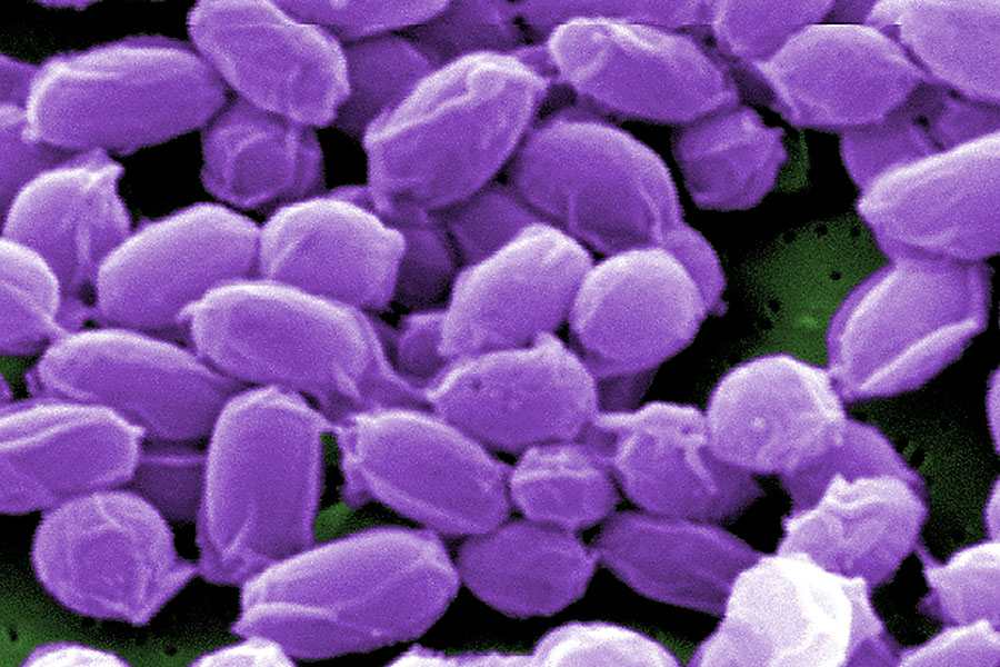 Under high magnification, this digitally-colorized scanning electron microscope image depicts endospores from Bacillus anthracis bacteria. These endospores can live for many years, which enables these bacteria to survive in a dormant state. (Image Courtesy: Centers for Disease Control and Prevention)