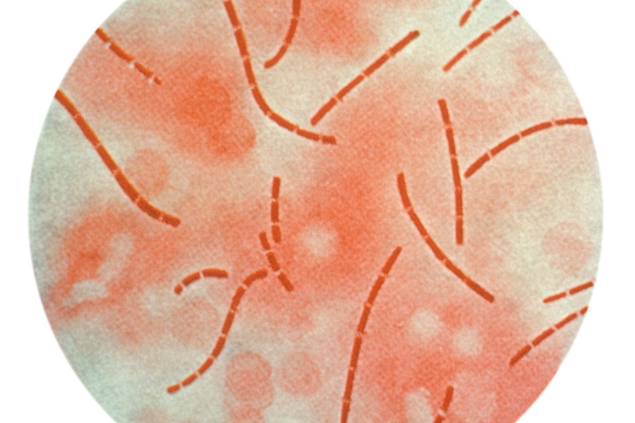 A photomicrographic view of Bacillus anthracis bacteria taken from heart blood and processed using a carbol-fuchsin stain. (Image Courtesy: Centers for Disease Control and Prevention)